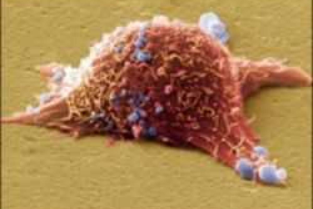 Впервые биологи смогли проследить, как развивается рак кожи Впервые биологи смогли проследить, как развивается рак кожи