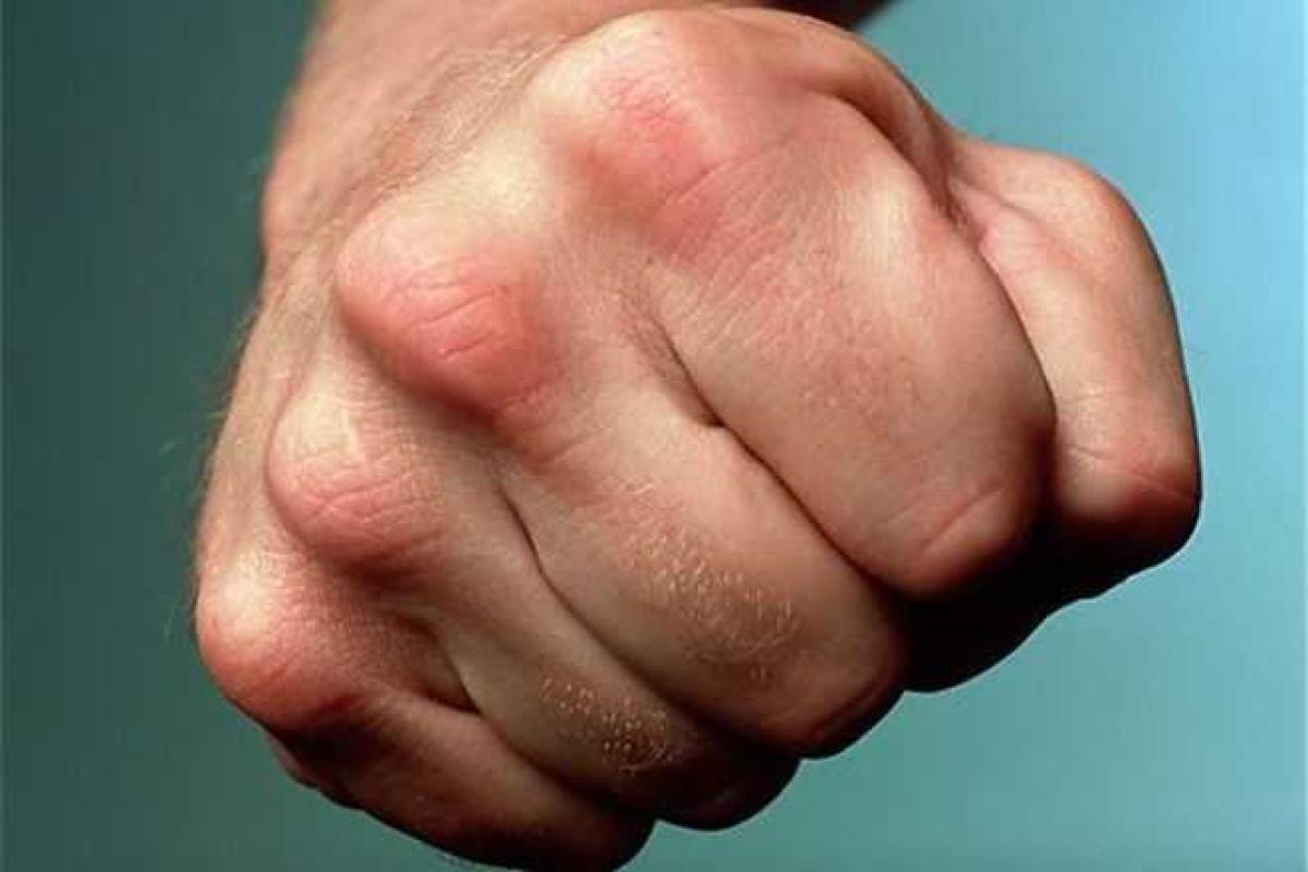 В Северодонецке жестоко избили председателя окружной избирательной комиссии
