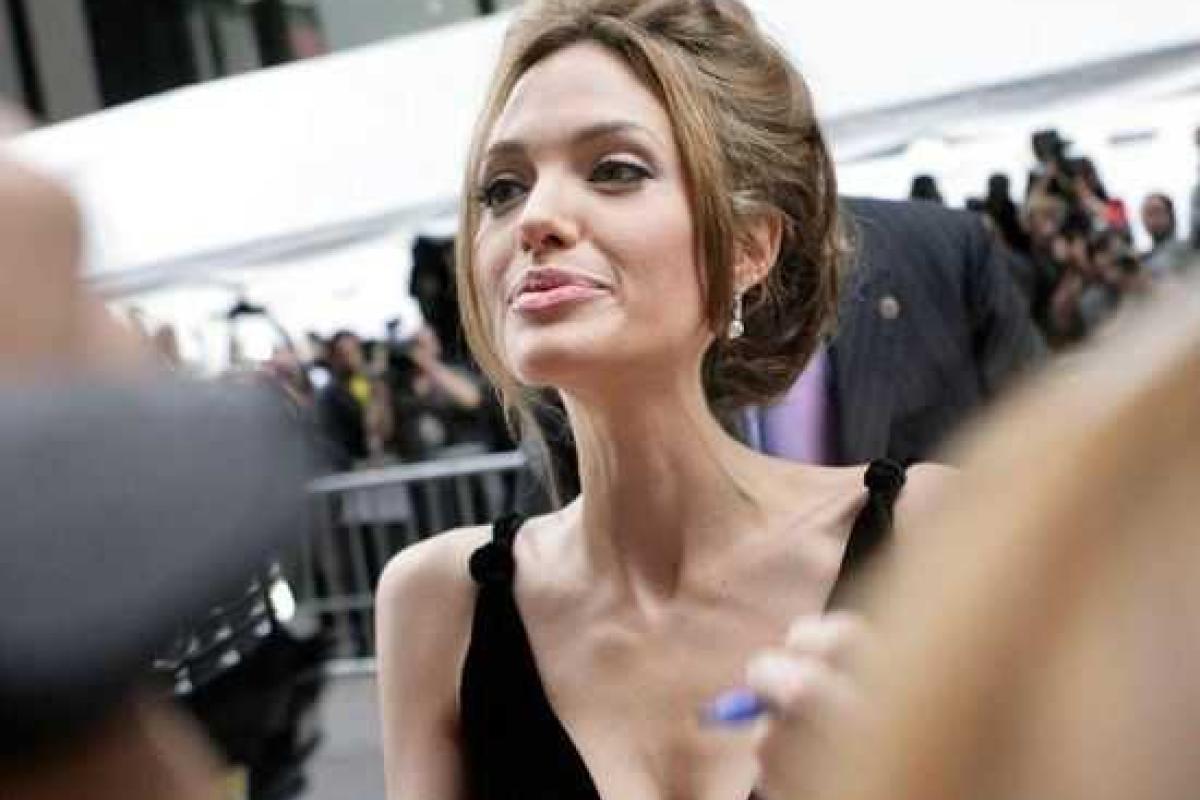 Десять звезд, которым похудение не пошло на пользу