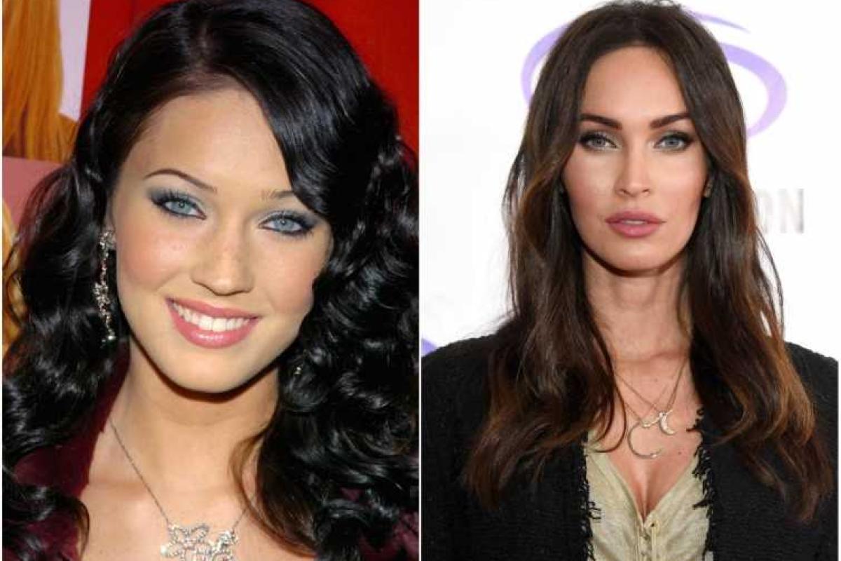 Восемь знаменитостей, которым пластические операции пошли на пользу