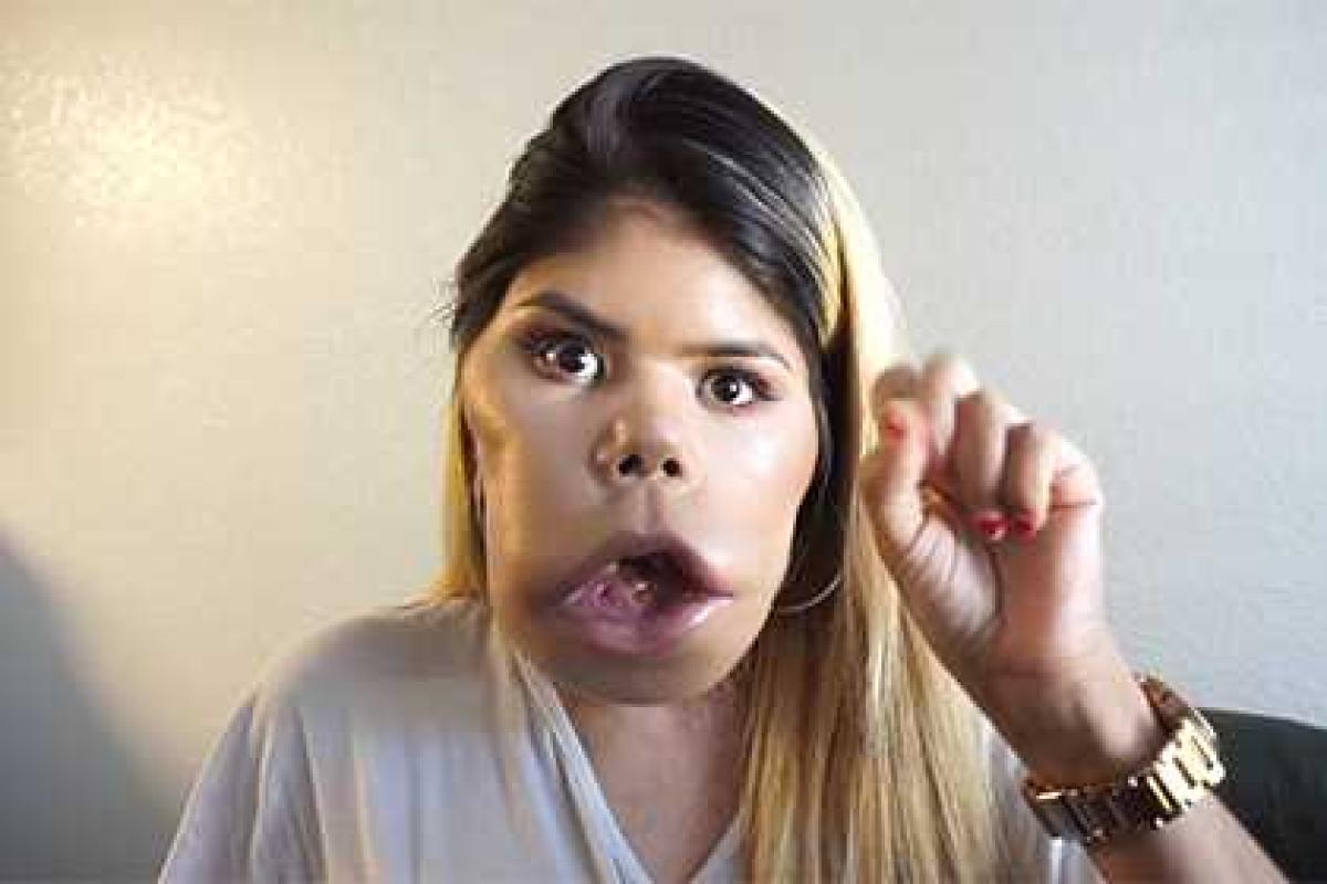 Бьюти-блогер с деформированным лицом стала звездой YouTube Бьюти-блогер с деформированным лицом стала звездой YouTube