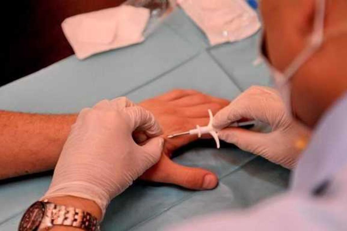 В Украине впервые вживили чип в руку человека