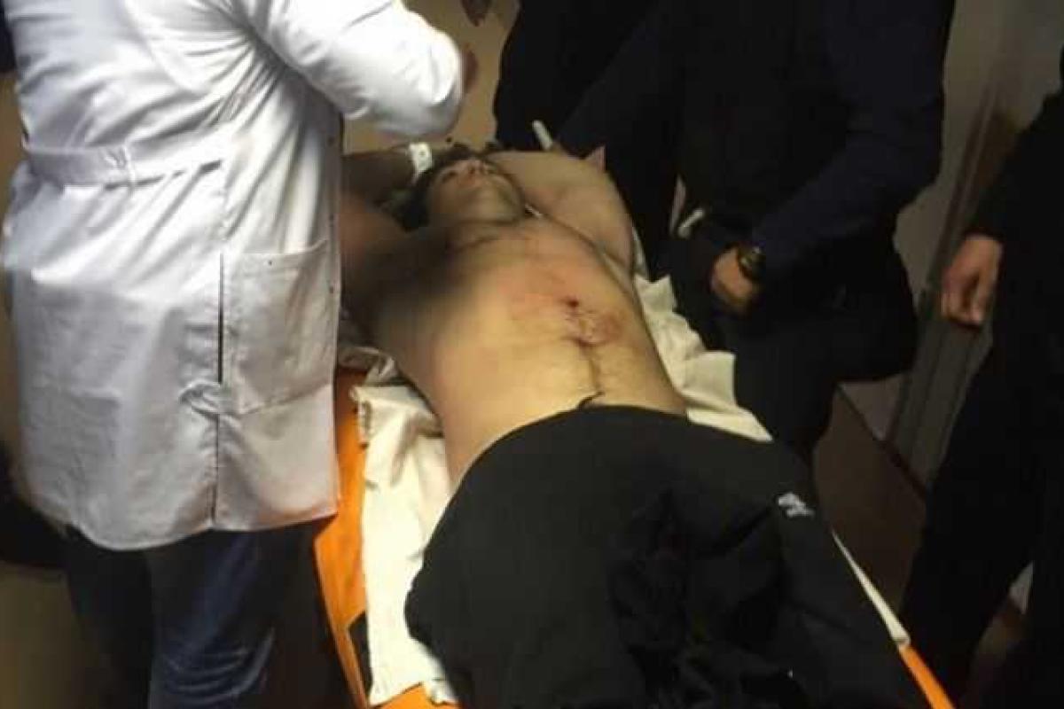 Врачи спасли жизнь убийце патрульных Пугачеву Врачи спасли жизнь убийце патрульных Пугачеву