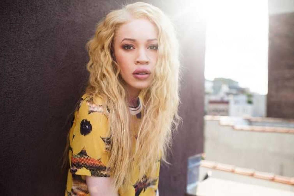 Десять необычных моделей, которые перевернули мир моды