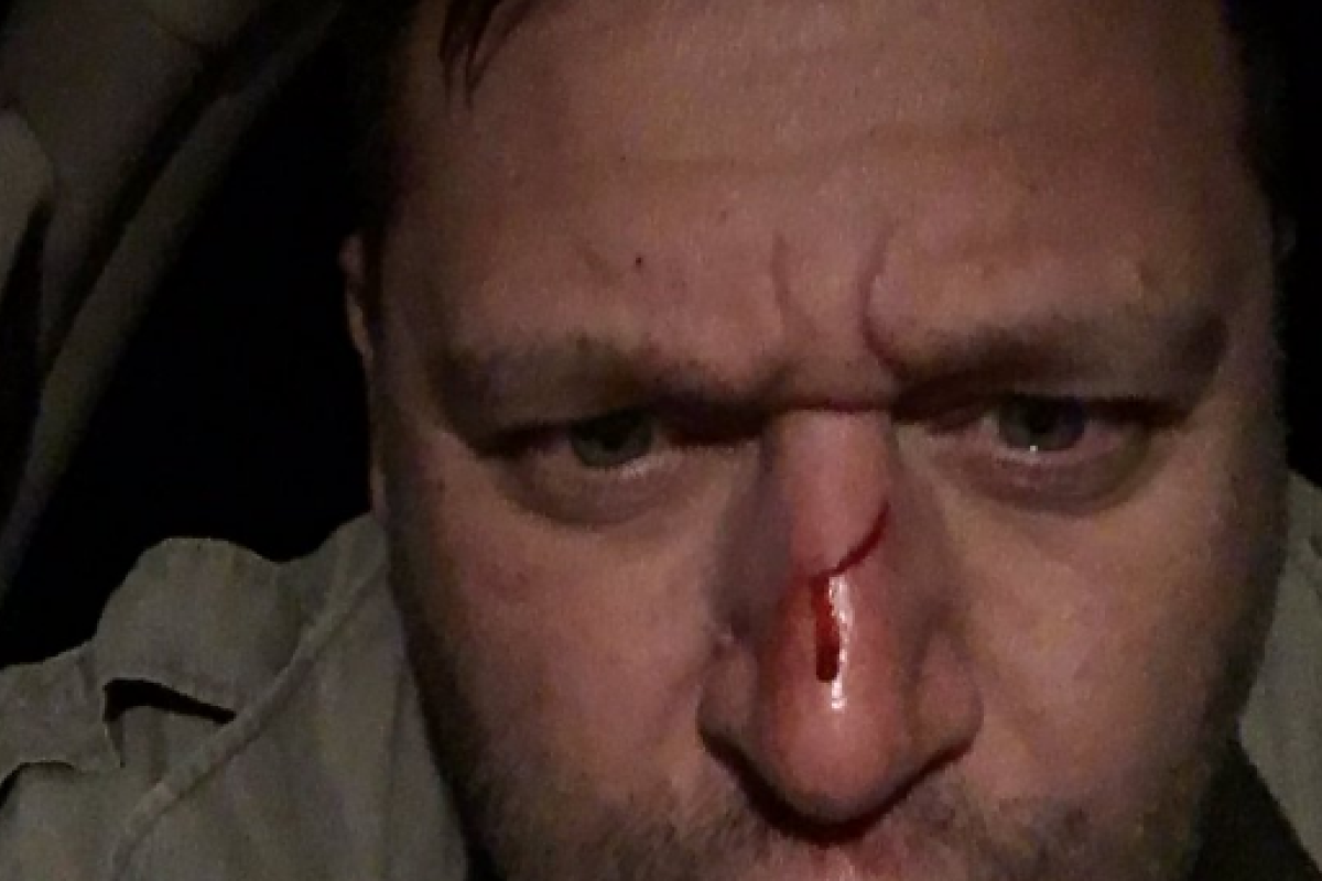 Михаил Добкин получил ранение во время отстрела свиней