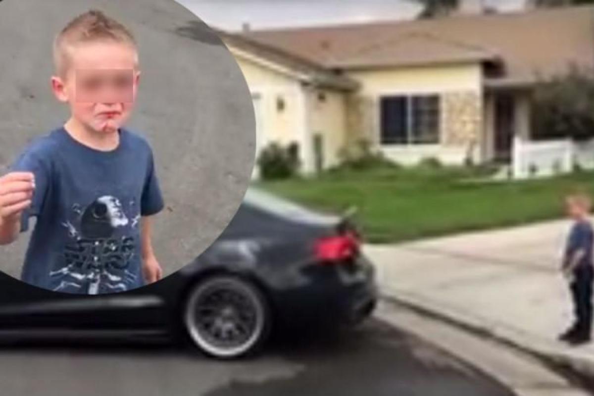 Отец удалил маленькому сыну зуб с помощью Audi S5: опубликовано видео