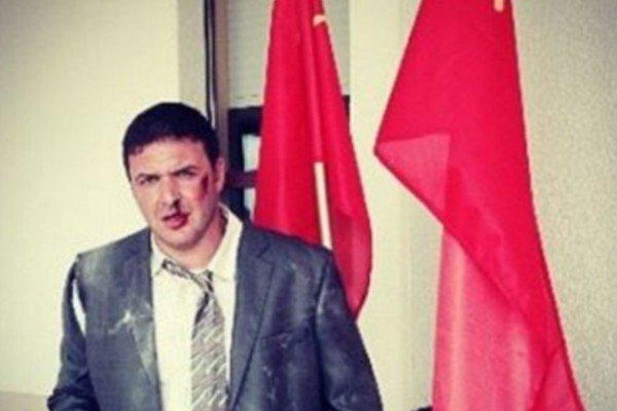 Максим Виторган напугал фанатов снимком с разбитым лицом