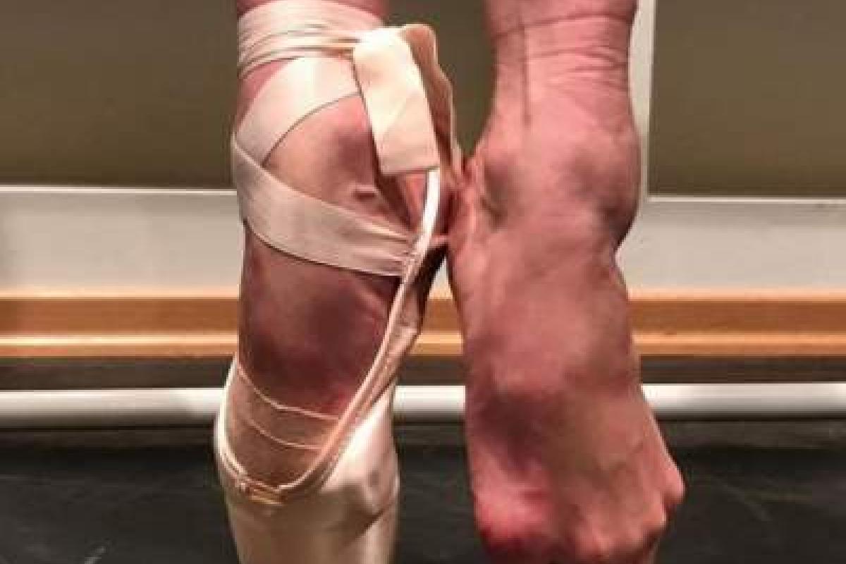 Анастасия Волочкова шокировала фанатов "ногами балерины"