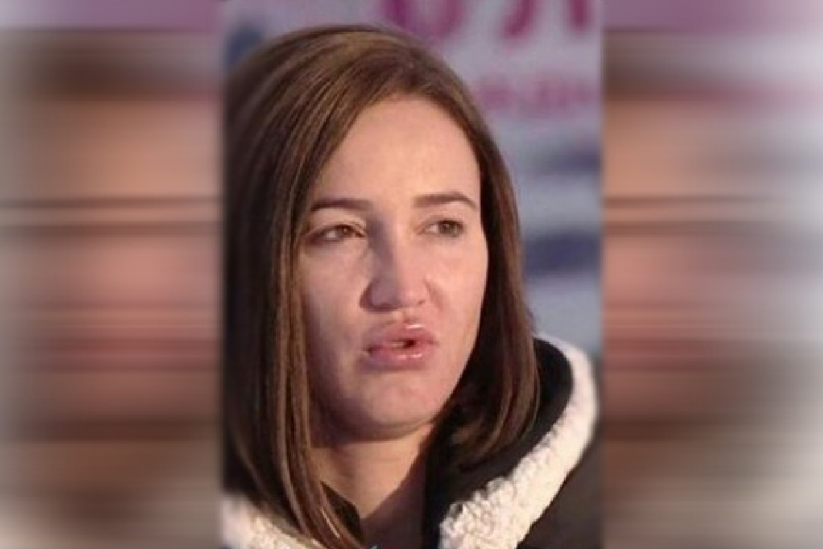 Ольга Бузова шокировала опухшим лицом