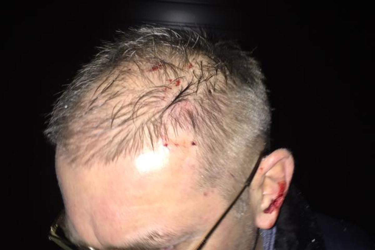 Пашинский рассказал детали стычки и показал свои увечья