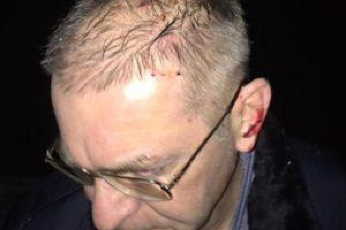 Советник главы МВД: Пашинский был вынужден применить оружие Советник главы МВД: Пашинский был вынужден применить оружие