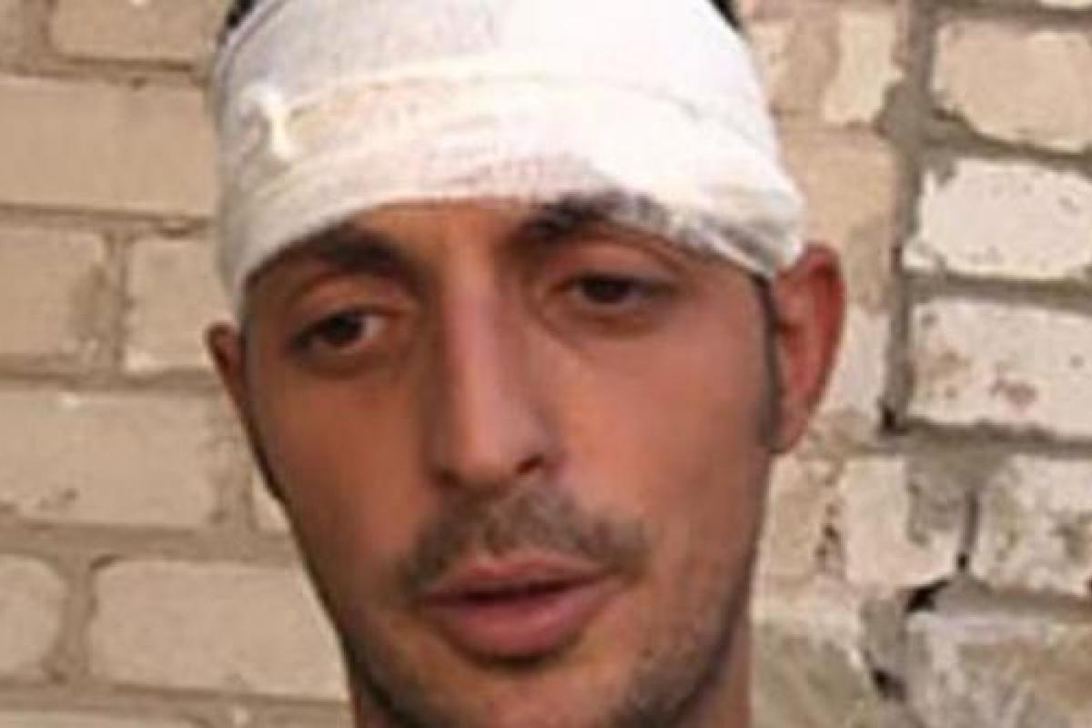 Совещание командиров банды "Сомали" завершилось стрельбой, террорист Гиви ранен, - соцсети