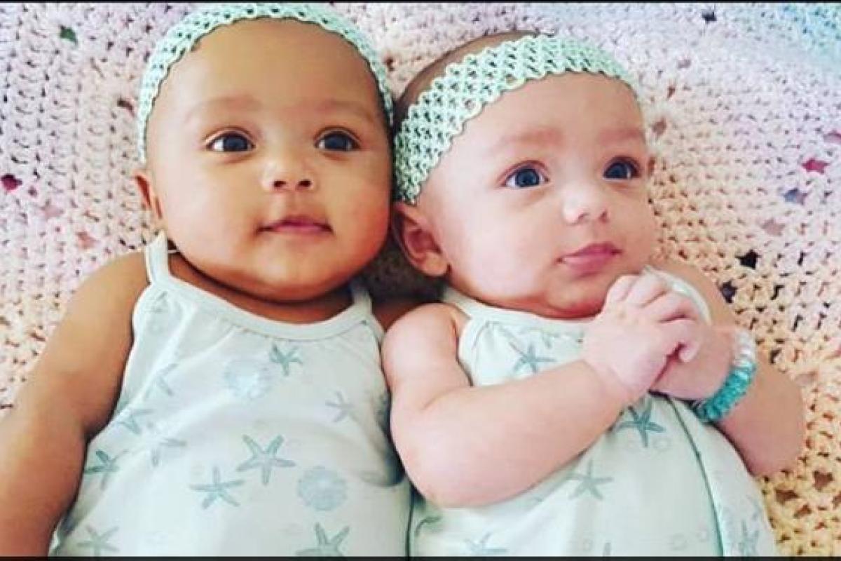 Удивительные близняшки появились на свет в США: удивлены не только родители, но и врачи