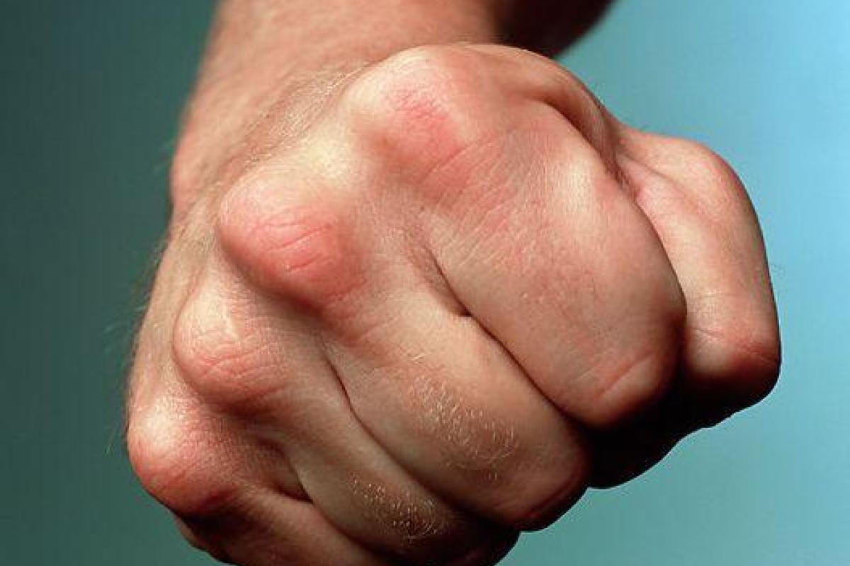 В Черкассах произошел вопиющий инцидент: пьяный депутат жестоко избил афганца В Черкассах произошел вопиющий инцидент: пьяный депутат жестоко избил афганца