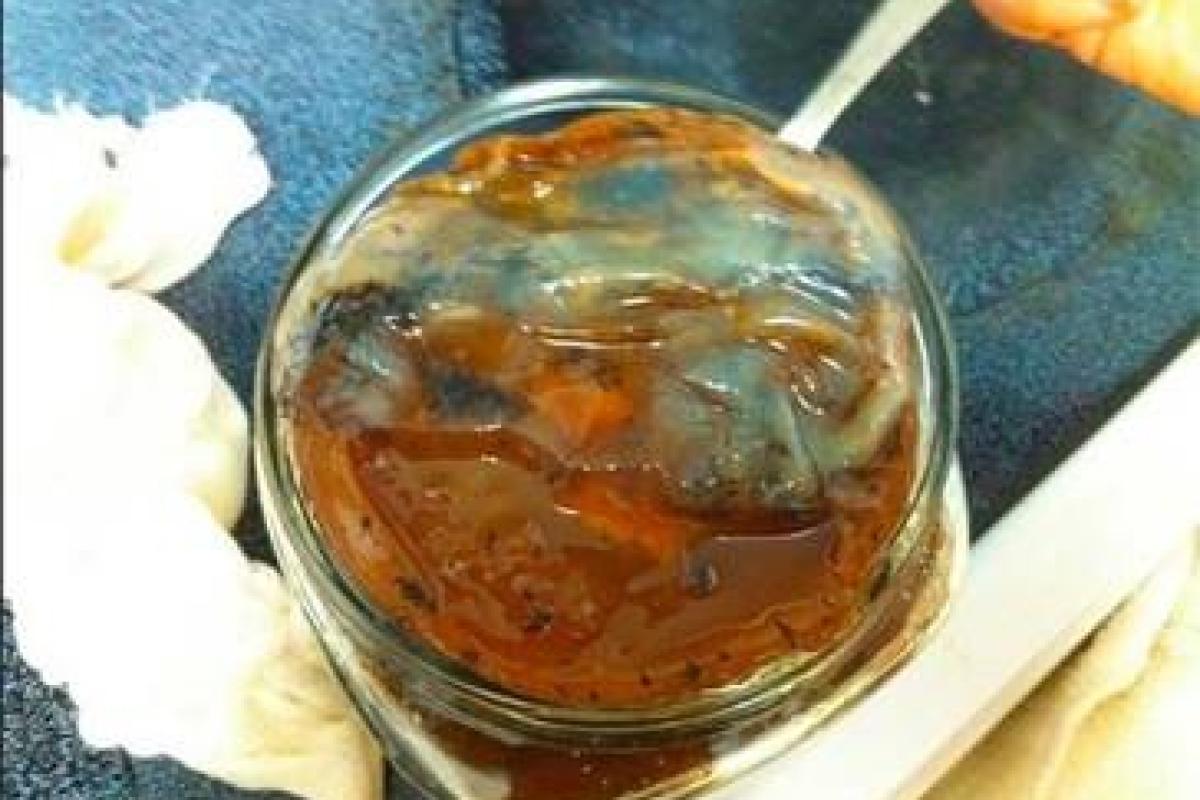 В желудке китаянки выросла колония грибов: медики рассказали шокирующие подробности