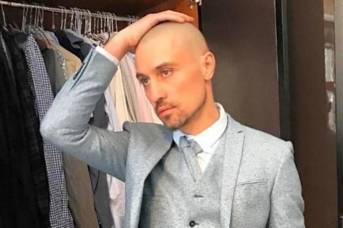 Дима Билан полностью облысел: фанаты переживают за его здоровье Дима Билан полностью облысел: фанаты переживают за его здоровье