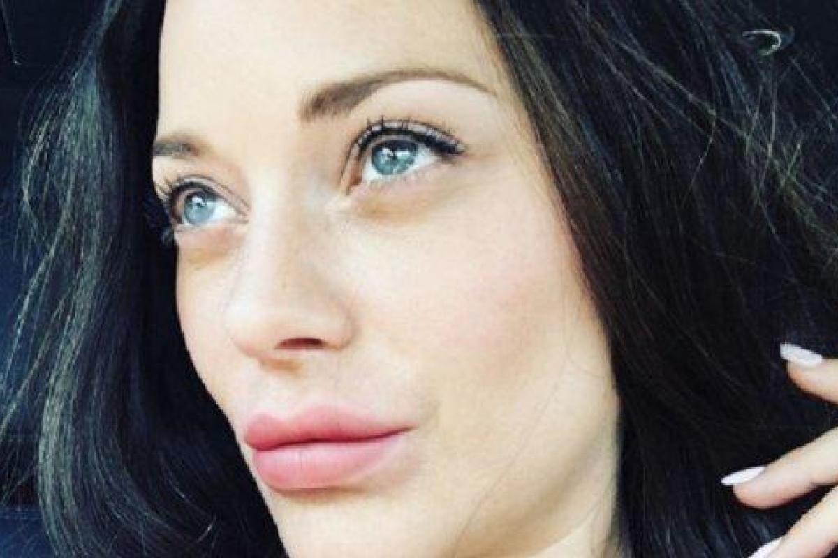 Популярная актриса шокировала фанатов своими губами