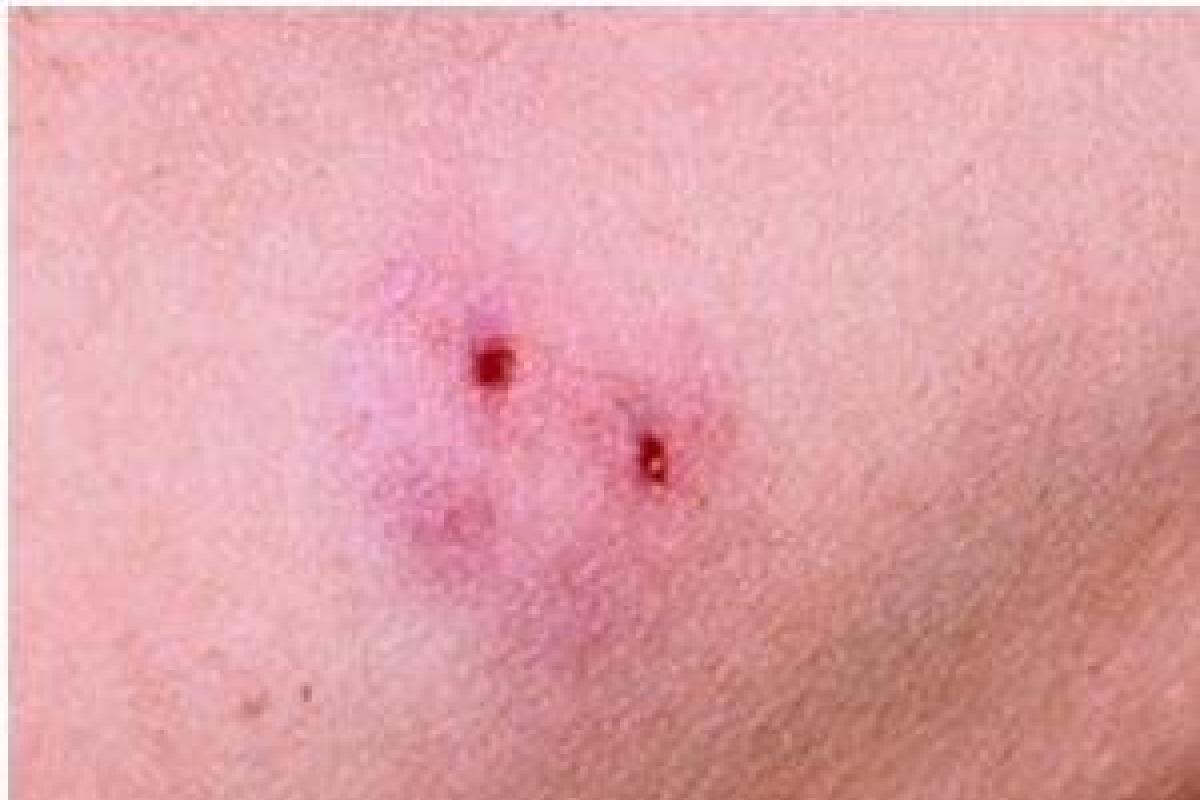 В Киеве человека укусила ядовитая змея