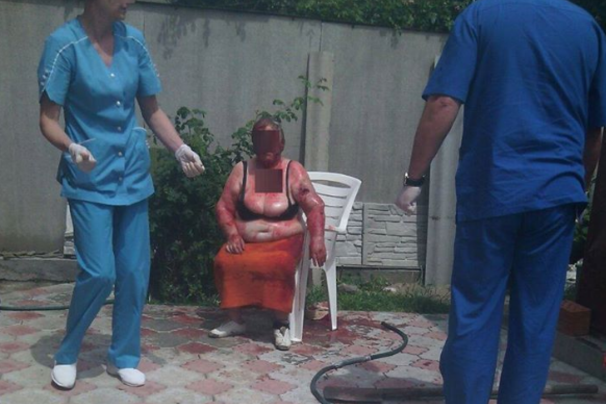 В Николаеве патрульные полицейские убили собаку, которая разрывала женщину