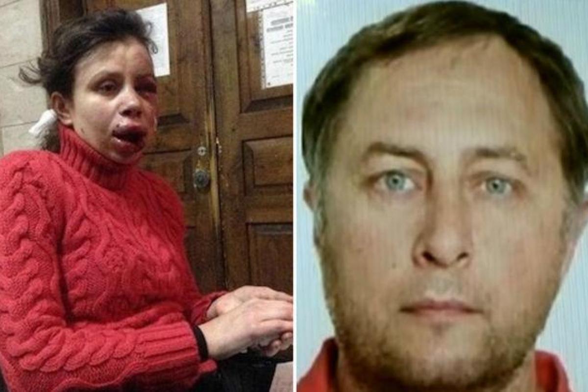 В Киеве нашли повешенным одного из подозреваемых в нападении на Татьяну Черновол — журналист
