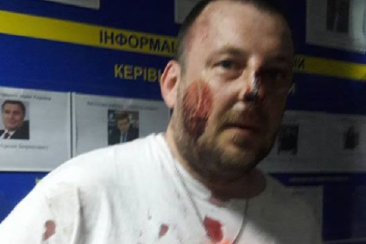 Волонтер сообщил о жестоком избиении участников АТО полицейскими Волонтер сообщил о жестоком избиении участников АТО полицейскими