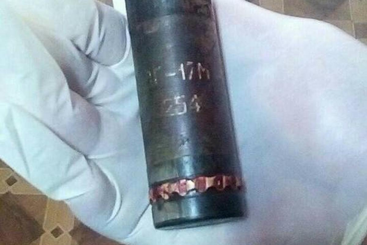 Врачам удалось спасти бойца ВСУ, у которого в ноге застряла неразорвавшаяся граната Врачам удалось спасти бойца ВСУ, у которого в ноге застряла неразорвавшаяся граната