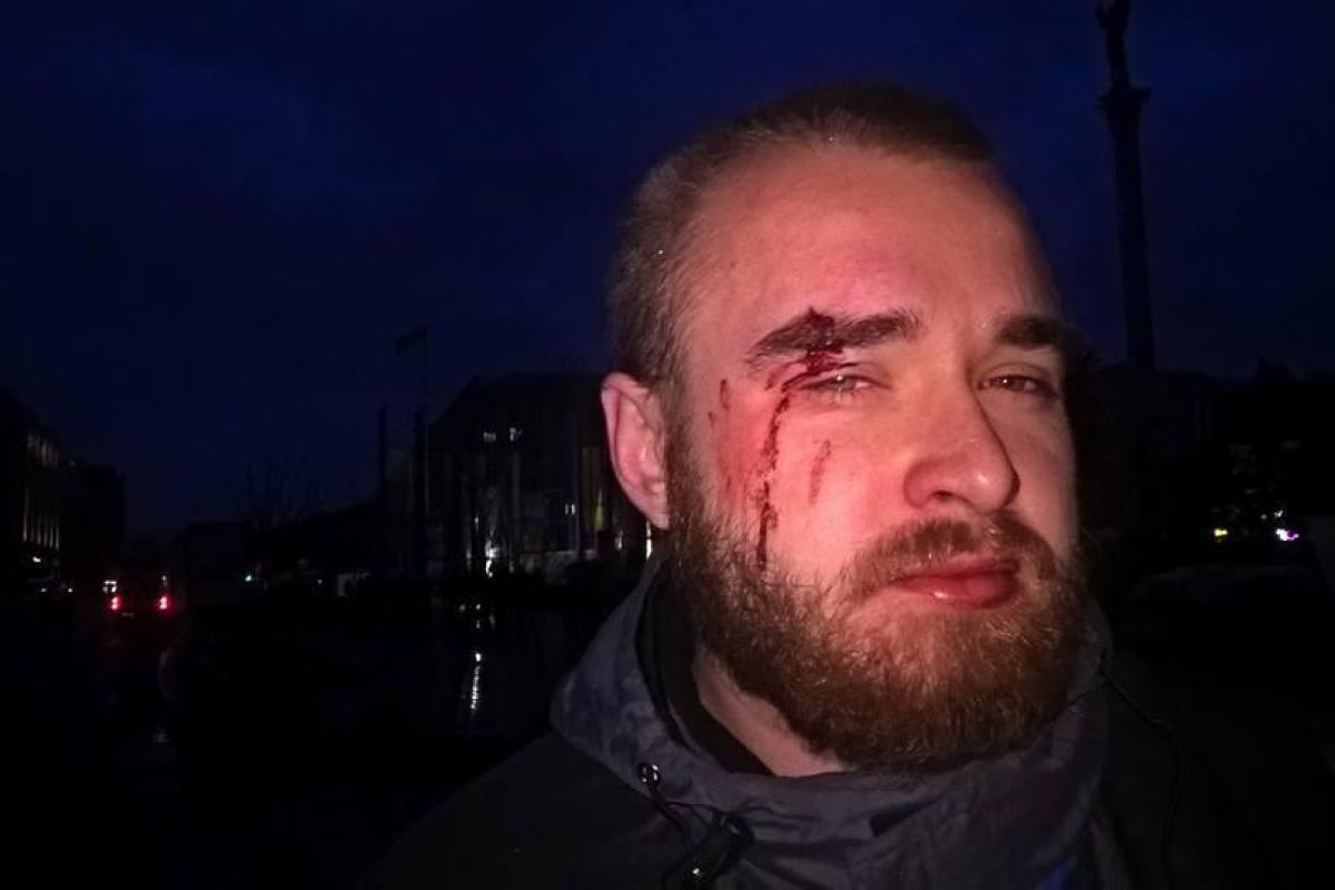 В Киеве жестоко избили известного «киборга»: опубликованы снимки нападавшего В Киеве жестоко избили известного «киборга»: опубликованы снимки нападавшего