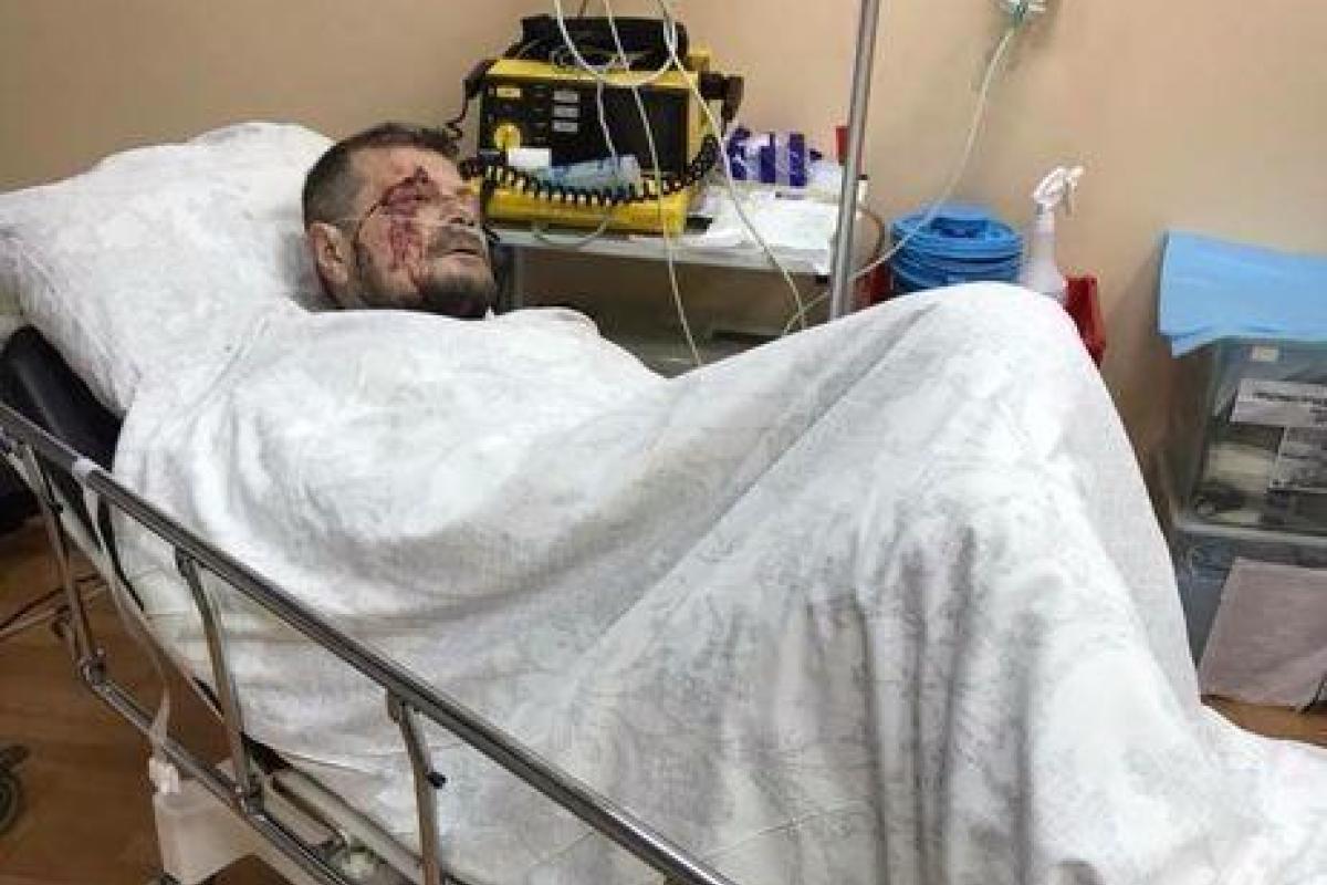 "Для них было бы лучше, чтобы я умер": Мосийчук лично будет вести следствие по делу о теракте "Для них было бы лучше, чтобы я умер": Мосийчук лично будет вести следствие по делу о теракте