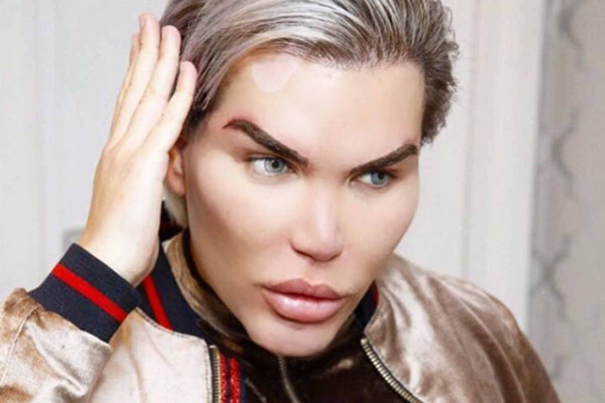 "Юбилейная" пластическая операция: "человек-Кен" Родриго Алвес решился на удаление костей "Юбилейная" пластическая операция: "человек-Кен" Родриго Алвес решился на удаление костей