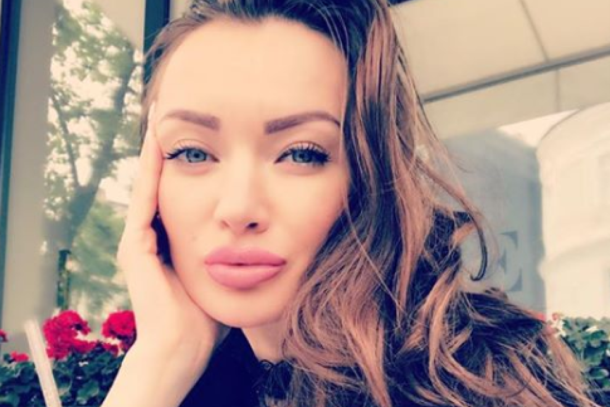 Взрыв автомобиля на Бессарабке: выжившая модель впервые рассказала о своем состоянии Взрыв автомобиля на Бессарабке: выжившая модель впервые рассказала о своем состоянии