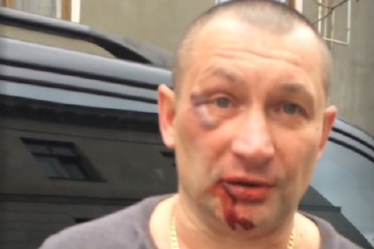 «В Ялте стало опасно быть украинцем»: местный житель показал, что с ним сделал сторонник «русского мира» «В Ялте стало опасно быть украинцем»: местный житель показал, что с ним сделал сторонник «русского мира»