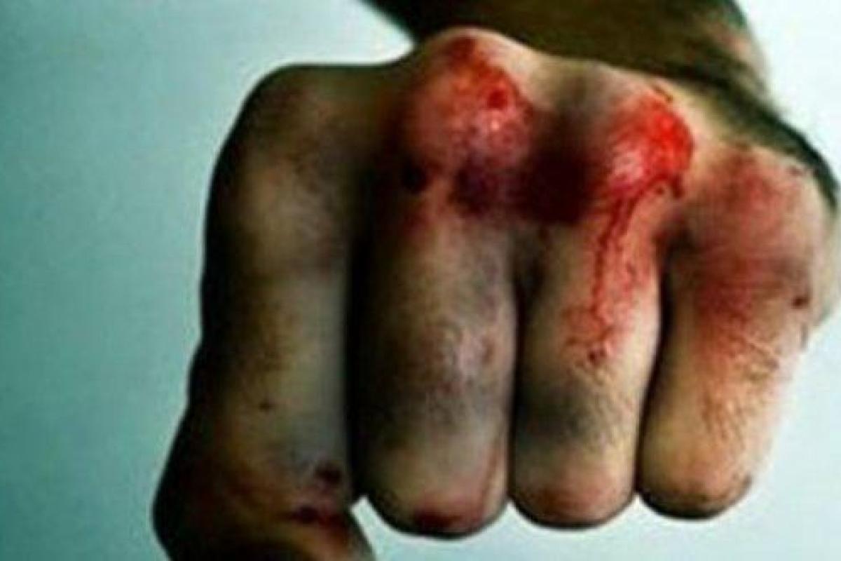 В Затоке отдыхающие устроили смертельную драку В Затоке отдыхающие устроили смертельную драку