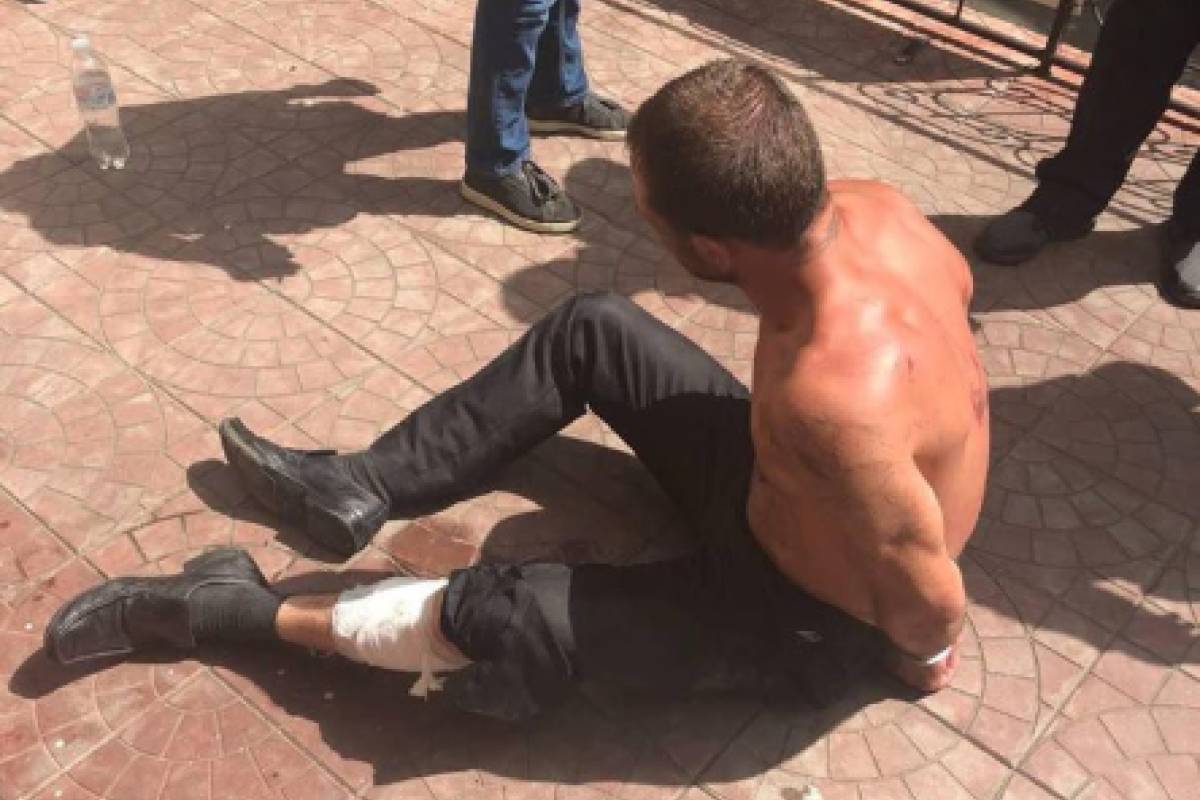 В Киеве патрульные подстрелили агрессивного мужчину, который находился в розыске В Киеве патрульные подстрелили агрессивного мужчину, который находился в розыске