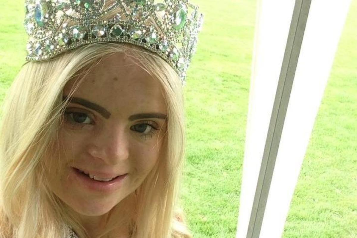 Модель с синдромом Дауна впервые выиграла конкурс красоты Модель с синдромом Дауна впервые выиграла конкурс красоты
