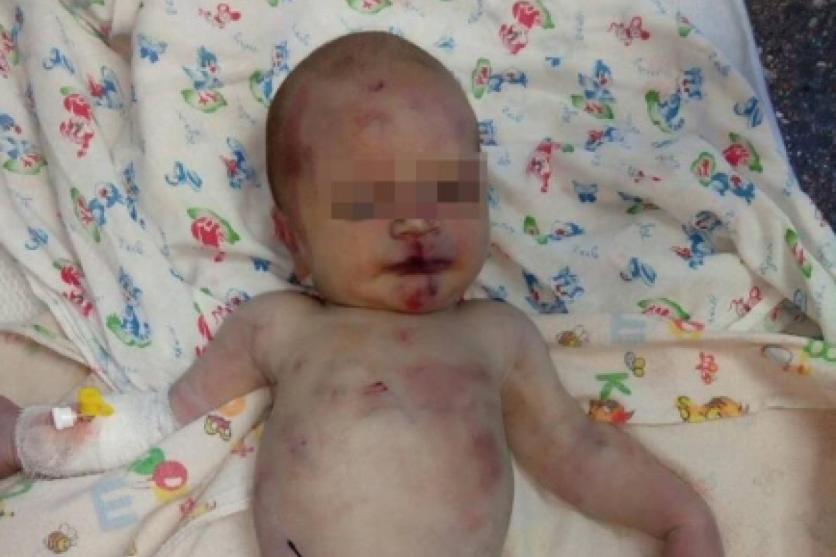На Николаевщине в больницу подбросили жестоко избитого младенца На Николаевщине в больницу подбросили жестоко избитого младенца