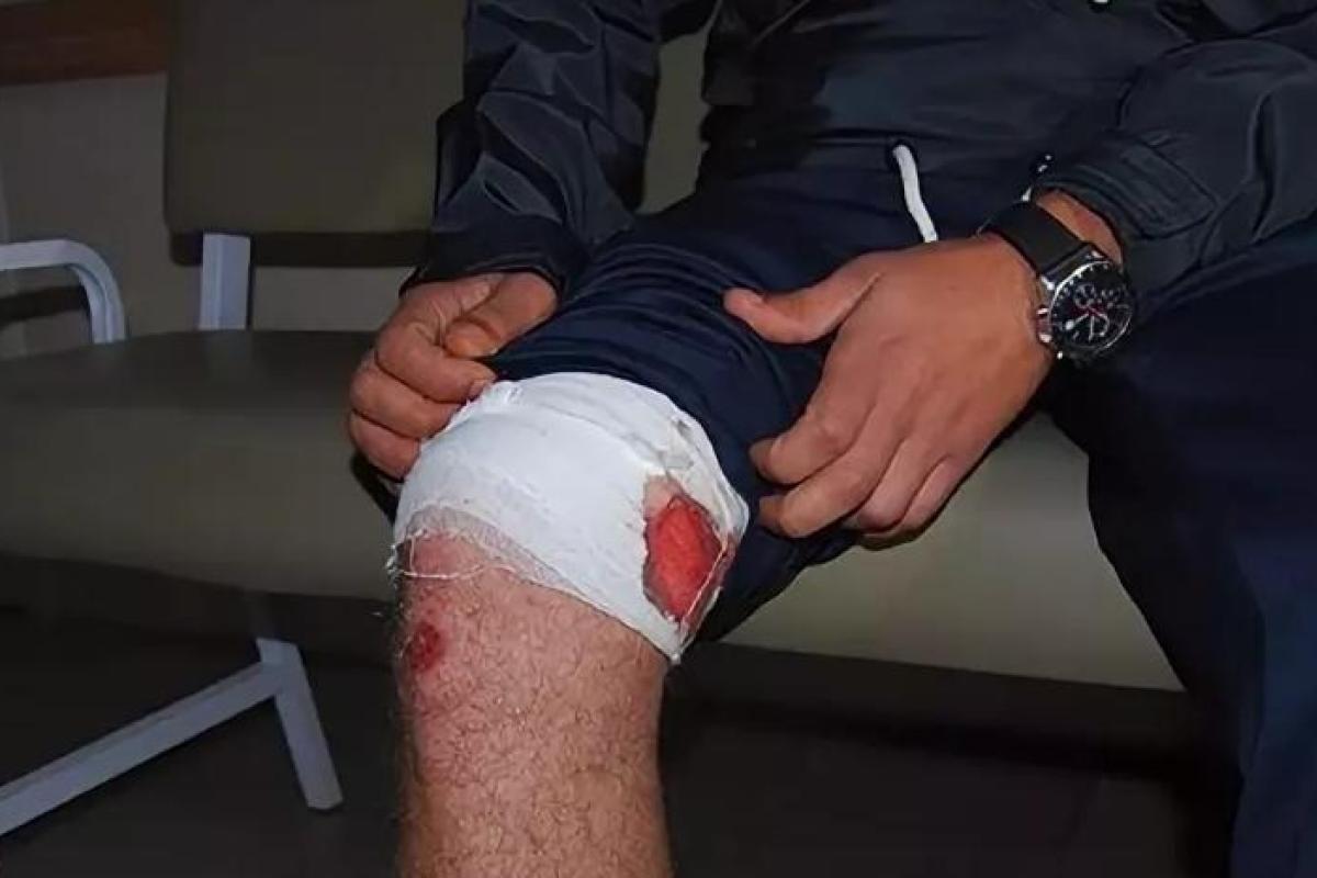 Россиянин на спор прострелил себе ногу