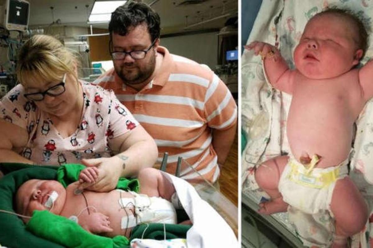 "Это рекорд в истории больницы": В Техасе родился ребенок весом более 6 кг