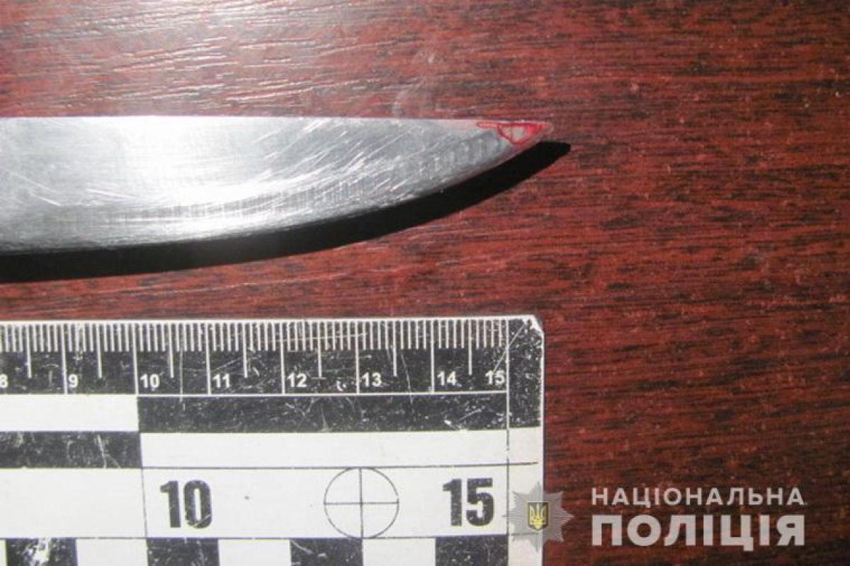Вместе выпивали: В Северодонецке 22-летняя девушка ранила ножом знакомого