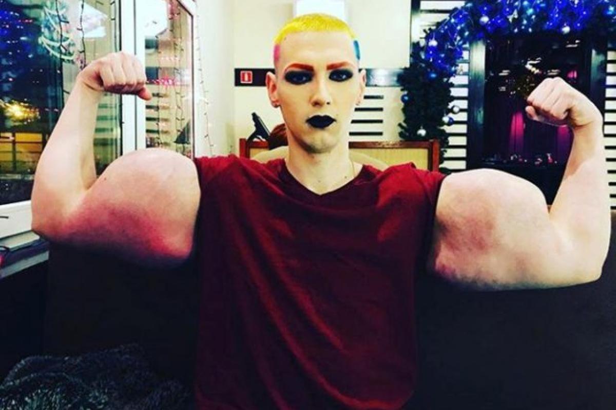 Не синтол: Кирилл Терешин закачал себе в "руки-базуки" 6 литров вазелина Не синтол: Кирилл Терешин закачал себе в "руки-базуки" 6 литров вазелина