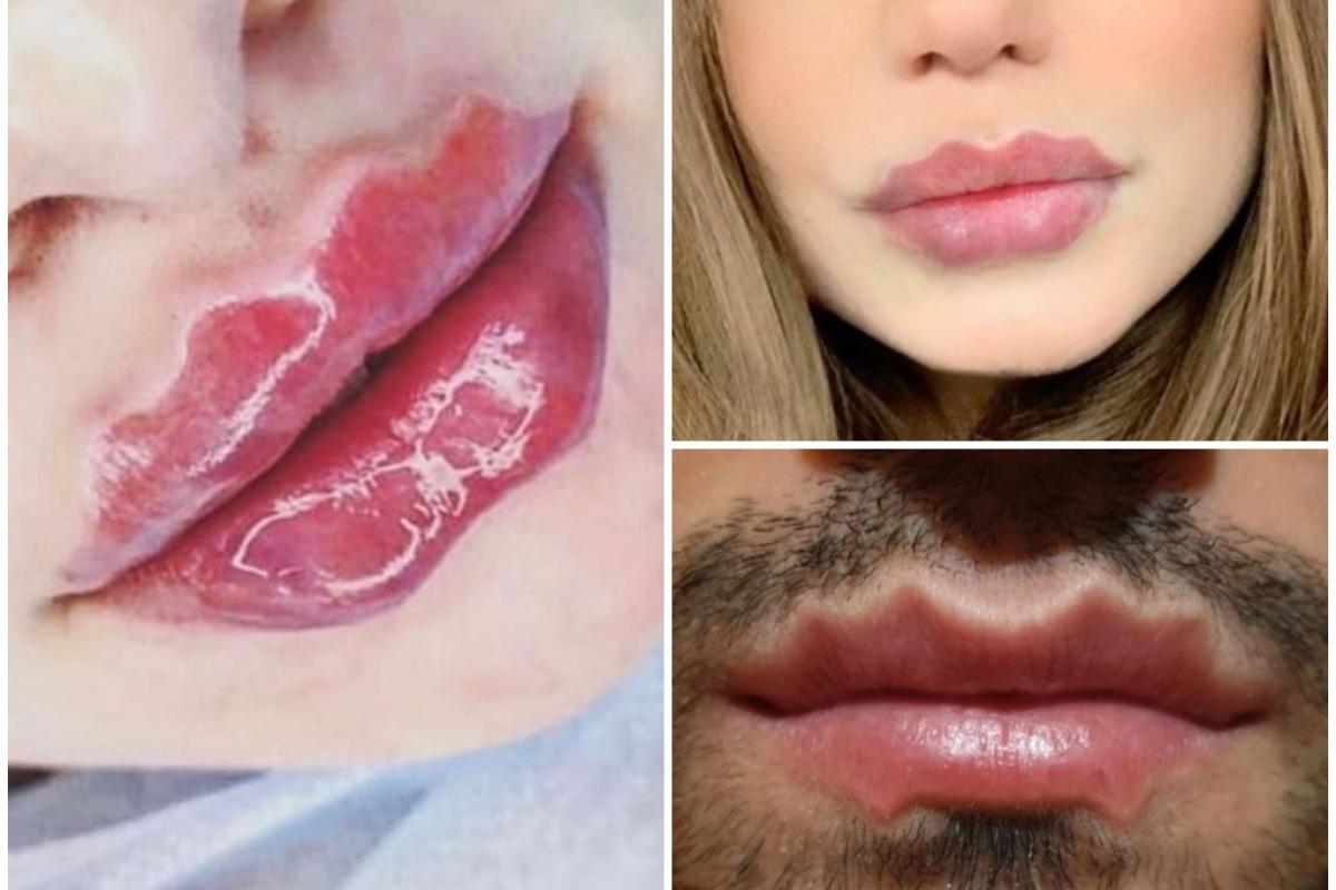 Губы-осьминоги: пользователей сети пугает сумасшедший модный тренд Губы-осьминоги: пользователей сети пугает сумасшедший модный тренд