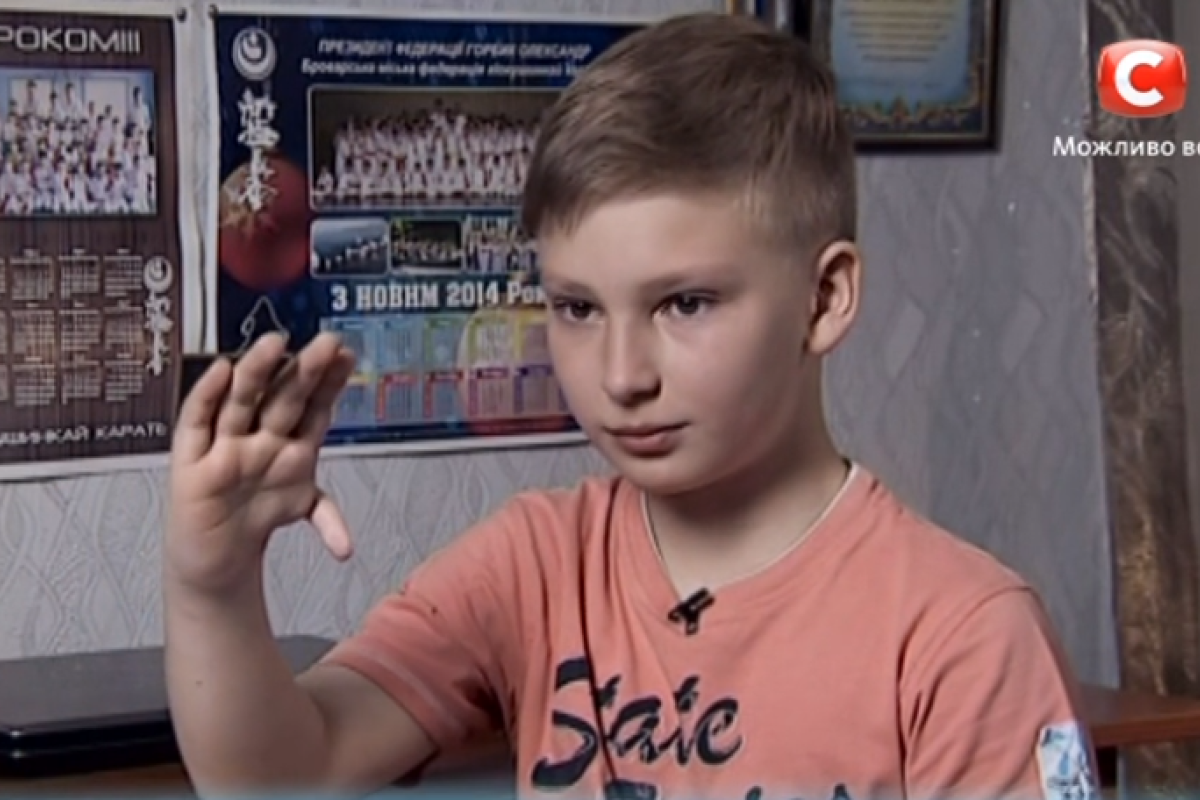 На проекте "Я стесняюсь своего тела" юному пациенту "пересадили" палец На проекте "Я стесняюсь своего тела" юному пациенту "пересадили" палец