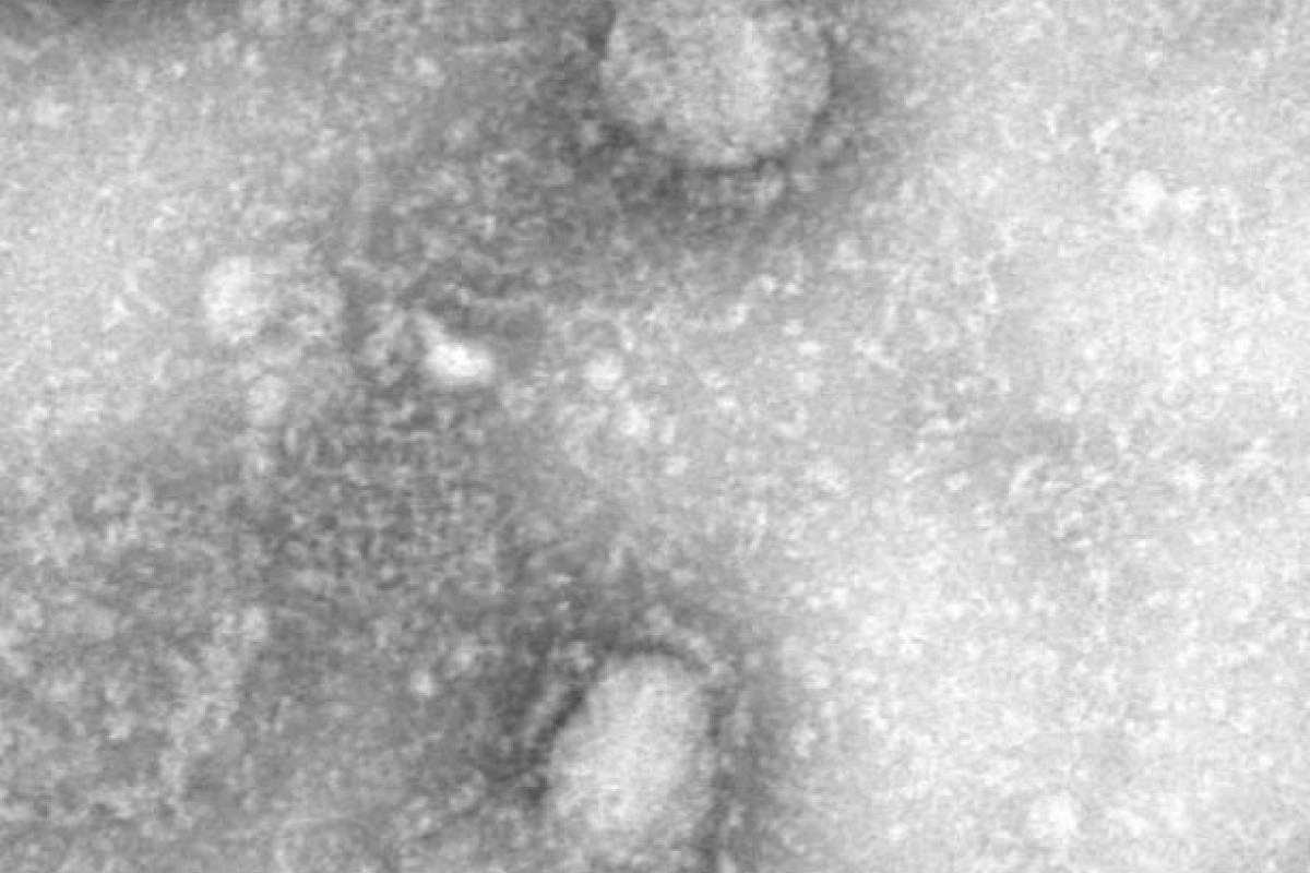 Смертельный китайский вирус: вакцина против него появится уже через три месяца Смертельный китайский вирус: вакцина против него появится уже через три месяца