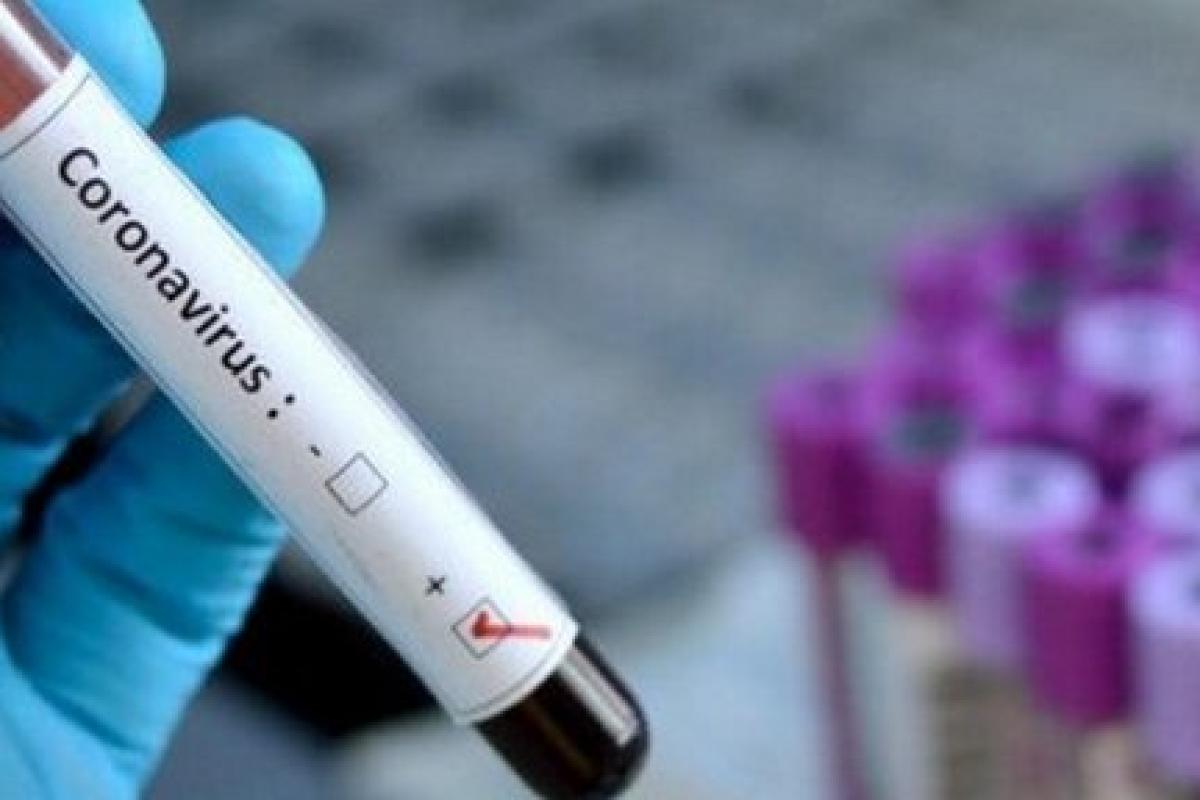 В Дружковке умер мужчина с подозрением на коронавирус В Дружковке умер мужчина с подозрением на коронавирус