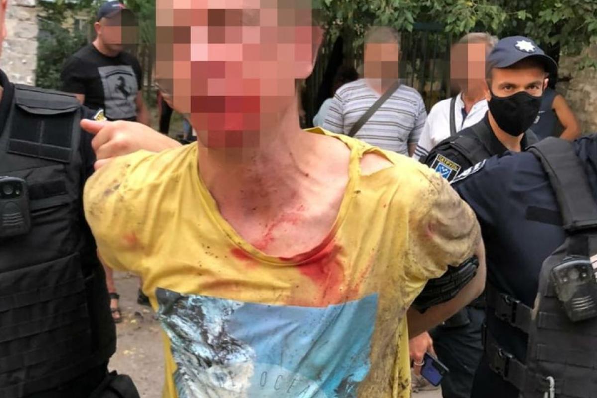 В Днепре мужчина бросил гранату в сторону людей, есть раненые В Днепре мужчина бросил гранату в сторону людей, есть раненые