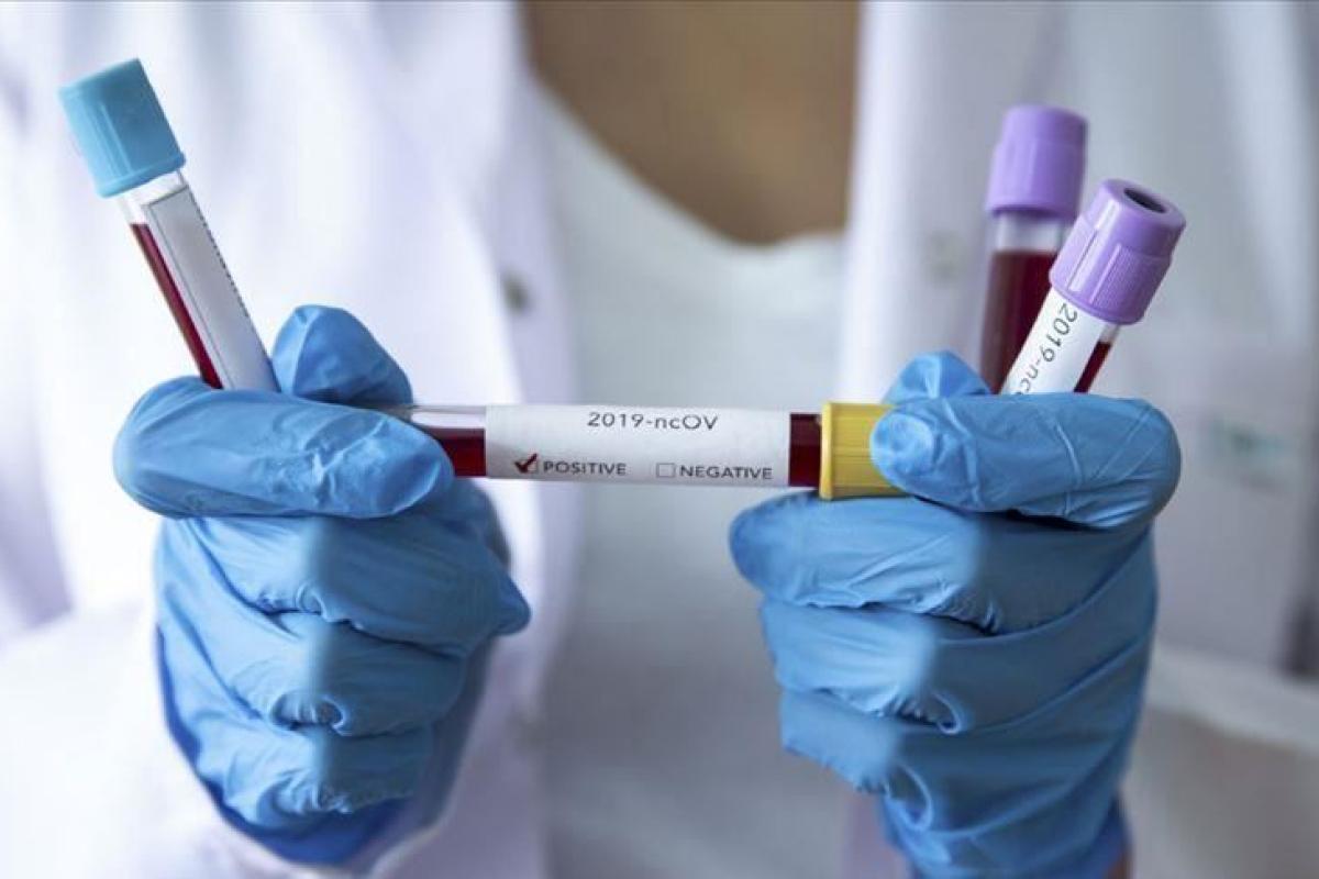 За минулу добу в Сєвєродонецьку від COVID-19 померли 7 осіб За минулу добу в Сєвєродонецьку від COVID-19 померли 7 осіб