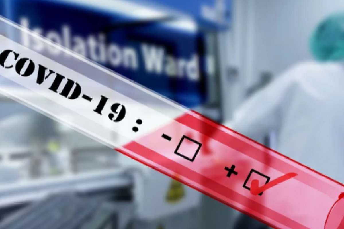 За минулу добу на Луганщині від COVID-19 померли 6 осіб За минулу добу на Луганщині від COVID-19 померли 6 осіб