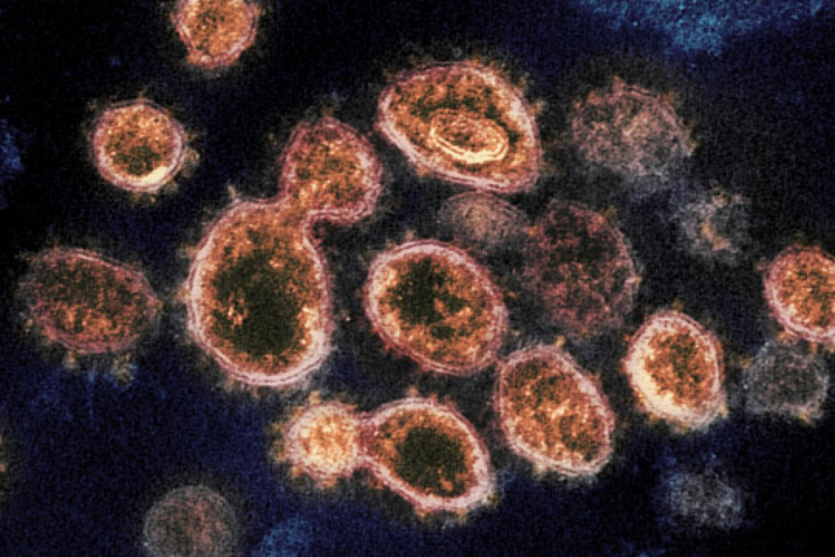 Мутированный британский коронавирус добрался до Канады Мутированный британский коронавирус добрался до Канады