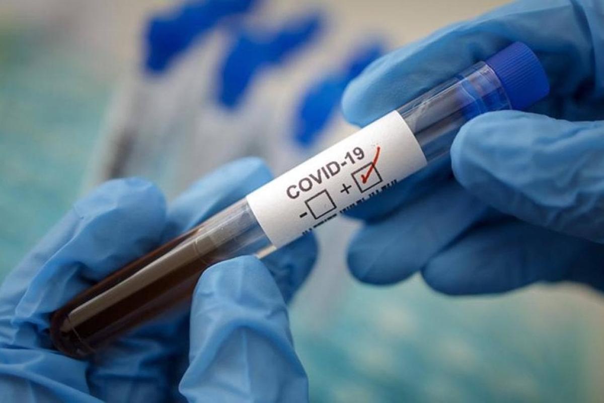 На Луганщині підтверджено ще 117 випадків COVID-19: найбільше нових хворих у Лисичанську