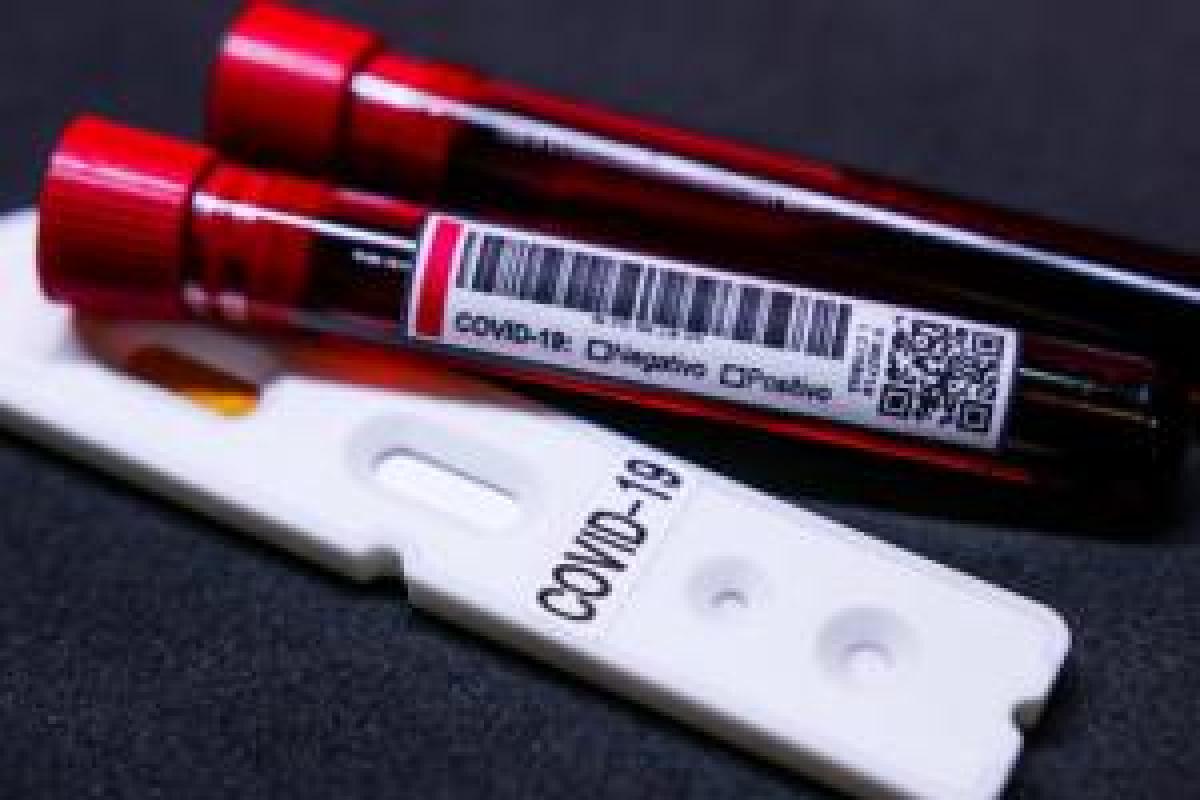 На Луганщині лабораторно підтверджено 161 новий випадок COVID-19 На Луганщині лабораторно підтверджено 161 новий випадок COVID-19