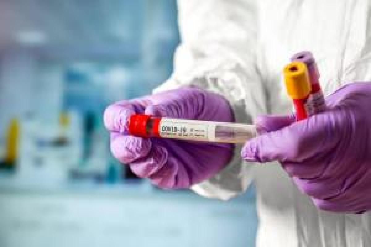 В Луганской области выявлено 184 новых случая COVID-19 В Луганской области выявлено 184 новых случая COVID-19